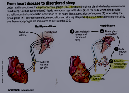 Heart disease to sleep disorder